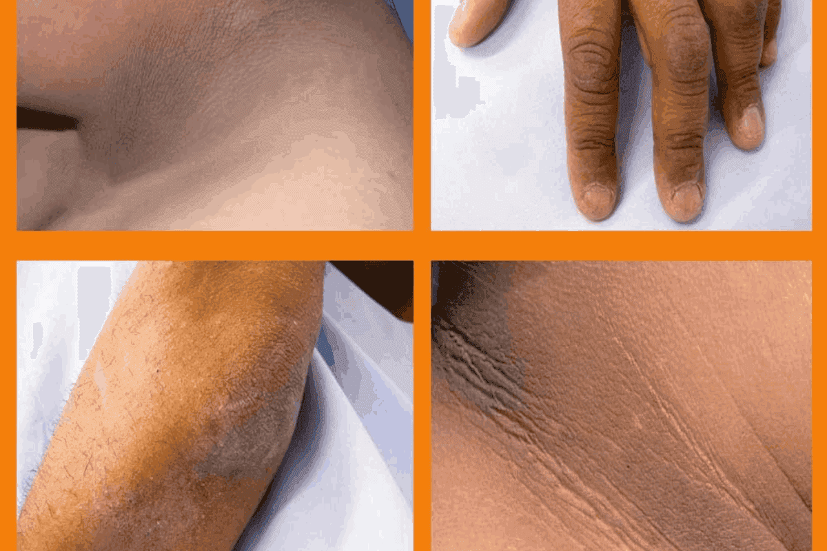 Which Treatment Is Best for Dark Knuckles?