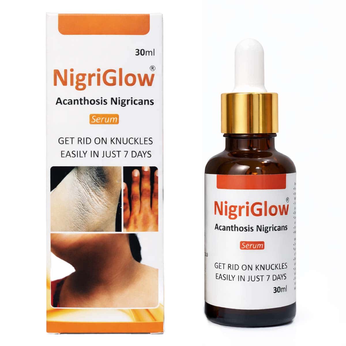 Nigriglow Acanthosis Nigricans Serum 30ml — lightens dark neck, armpits and inner thighs Pakistan