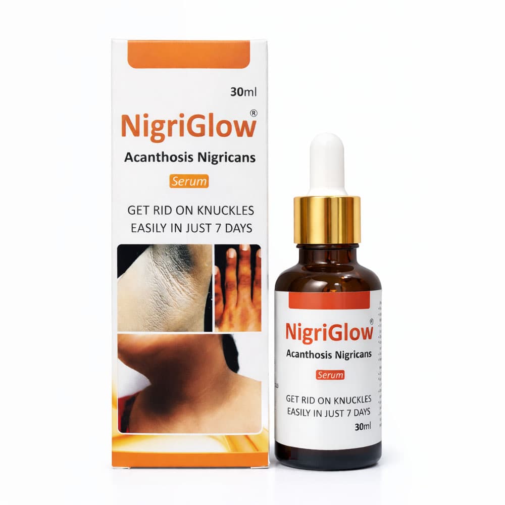 Nigriglow Acanthosis Nigricans Serum 30ml — lightens dark neck, armpits and inner thighs Pakistan