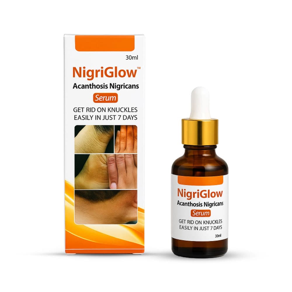 Nigriglow Acanthosis Nigricans Serum
