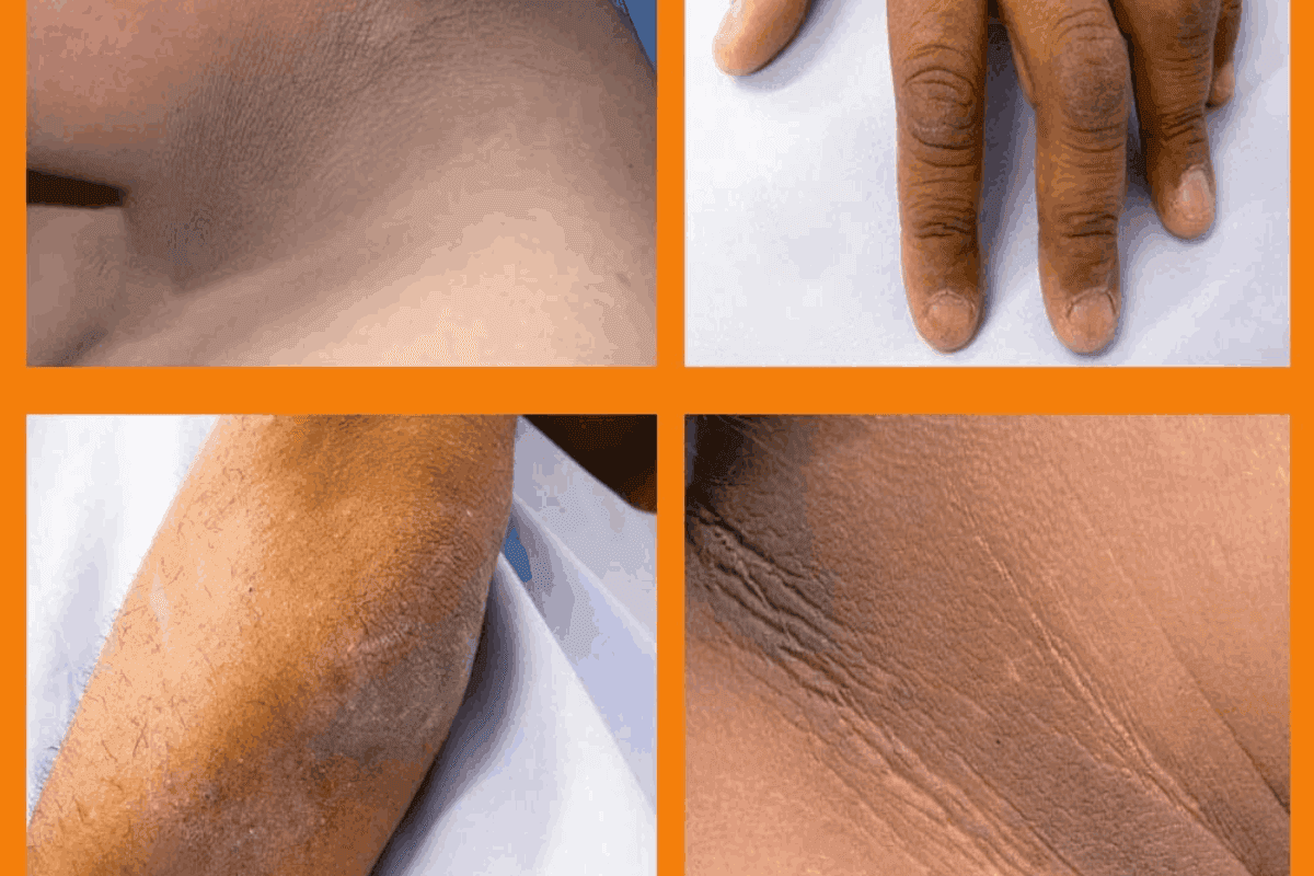 Which Treatment Is Best for Dark Knuckles?